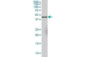 SYT11 monoclonal antibody (M03), clone 4E1 Western Blot analysis of SYT11 expression in IMR-32 .