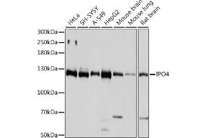 Western blot analysis of extracts of various cell lines, using IPO4 antibody  at 1:1000 dilution. (Importin 4 antibody  (AA 728-1081))