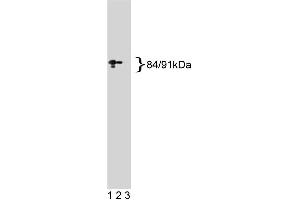 Western blot analysis of Stat1 on a A431 cell lysate. (STAT1 antibody  (AA 1-194))