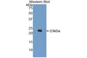 Western Blotting (WB) image for anti-Phosphoinositide-3-Kinase, Catalytic, beta Polypeptide (PIK3CB) (AA 321-507) antibody (ABIN1860219) (PIK3CB antibody  (AA 321-507))