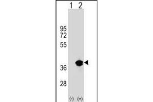 Western blot analysis of T1 (arrow) using rabbit polyclonal T1 Antibody (Center) (ABIN1538005 and ABIN2848794). (PPT1 antibody  (AA 189-217))