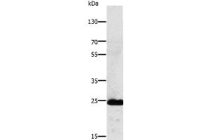 Western Blot analysis of Mouse lung tissue using RALB Polyclonal Antibody at dilution of 1:250 (RALB antibody)