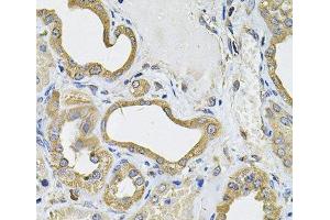Immunohistochemistry of paraffin-embedded Human kidney using ICOSL Polyclonal Antibody at dilution of 1:100 (40x lens). (ICOSLG antibody)