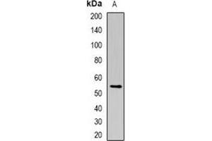 Western blot analysis of MCT4 expression in mouse skeletal muscle (A) whole cell lysates. (SLC16A3 antibody)