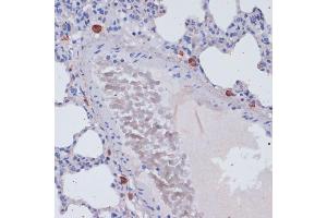 Immunohistochemistry of paraffin-embedded rat lung using Perforin antibody (ABIN3020641, ABIN3020642, ABIN3020643 and ABIN6213612) at dilution of 1:100 (40x lens). (Perforin 1 antibody  (AA 280-555))