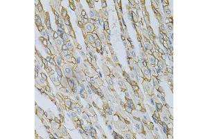 Immunohistochemistry of paraffin-embedded mouse stomach using AP2B1 Antibody (ABIN5971039) at dilution of 1/100 (40x lens). (AP2B1 antibody)