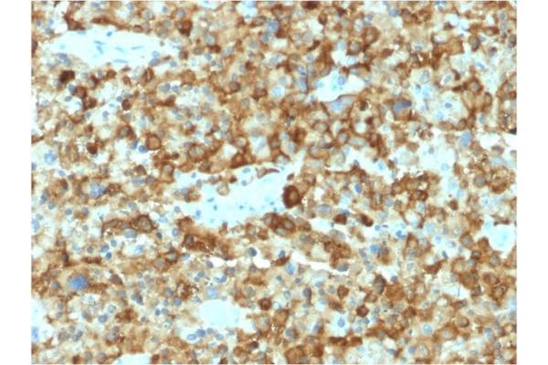 Melanoma gp100 antibody  (AA 376-502)
