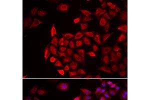 Immunofluorescence analysis of HeLa cells using COCH Polyclonal Antibody (COCH antibody)