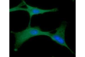 ICC/IF analysis of PGK1 in U87MG cells line, stained with DAPI (Blue) for nucleus staining and monoclonal anti-human PGK1 antibody (1:100) with goat anti-mouse IgG-Alexa fluor 488 conjugate (Green). (PGK1 antibody  (AA 1-417))