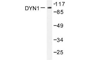 Image no. 1 for anti-Dynamin 1 (DNM1) antibody (ABIN271884) (Dynamin 1 antibody)