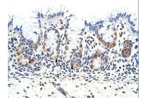 Image no. 1 for anti-Protein Kinase, Interferon-Inducible Double Stranded RNA Dependent Activator (PRKRA) (AA 141-190) antibody (ABIN6736195)