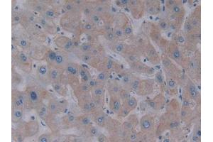 IHC-P analysis of Human Liver Tissue, with DAB staining. (Asialoglycoprotein Receptor 1 antibody  (AA 77-289))