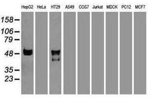 Image no. 2 for anti-serpin Peptidase Inhibitor, Clade A (Alpha-1 Antiproteinase, Antitrypsin), Member 1 (SERPINA1) (AA 26-418) antibody (ABIN1491294) (SERPINA1 antibody  (AA 26-418))