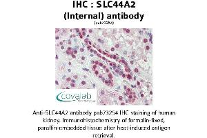 Image no. 1 for anti-Solute Carrier Family 44, Member 2 (SLC44A2) (Internal Region) antibody (ABIN1739381) (SLC44A2 antibody  (Internal Region))