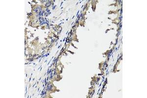 Immunohistochemistry of paraffin-embedded human prostate using OTC antibody. (OTC antibody  (AA 215-354))