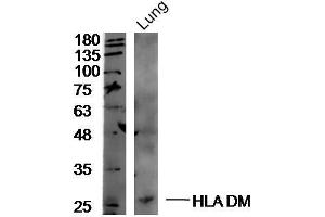 Mouse lung lysates probed with Rabbit Anti-HLA DM Polyclonal Antibody, Unconjugated  at 1:300 overnight at 4˚C.