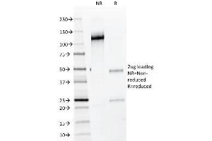 SDS-PAGE Analysis Purified NKX2. (Nkx2-2 antibody)