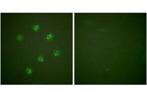 Immunofluorescence (IF) image for anti-Antigen Identified By Monoclonal Antibody Ki-67 (MKI67) (AA 3207-3256) antibody (ABIN2889217) (Ki-67 antibody  (AA 3207-3256))