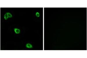 Immunofluorescence analysis of LOVO cells, using OR10K1/10K2 Antibody.