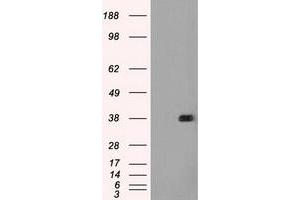 HEK293T cells were transfected with the pCMV6-ENTRY control (Left lane) or pCMV6-ENTRY FCGR2A (Right lane) cDNA for 48 hrs and lysed. (FCGR2A antibody)