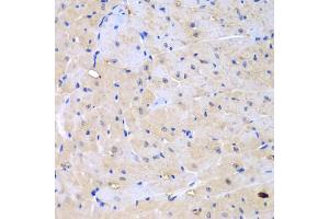 Immunohistochemistry of paraffin-embedded mouse heart using ARHGEF9 antibody (ABIN5975759) at dilution of 1/100 (40x lens). (Arhgef9 antibody)