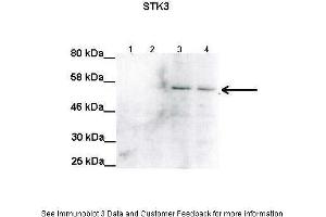 Lanes:   Lane1: 100ug uninduced RPE-1 lysate Lane2: 100ug uninduced RPE-1 lysate Lane3: 100ug STK3 induced RPE-1 lysate Lane4: 100ug STK3 induced RPE-1 lysate  Primary Antibody Dilution:   1:2000  Secondary Antibody:   Anti-rabbit HRP  Secondary Antibody Dilution:   1:5000  Gene Name:   STK3  Submitted by:   Anonymous (STK3 antibody  (C-Term))