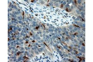 Immunohistochemical staining of paraffin-embedded Kidney tissue using anti-LIPG mouse monoclonal antibody. (LIPG antibody)