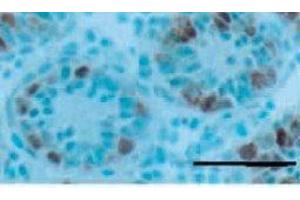 Western Blotting (WB) image for anti-Gena antibody (ABIN3201020) (Gena antibody)