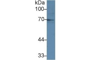Detection of IL1R1 in Human Raji cell lysate using Polyclonal Antibody to Interleukin 1 Receptor Type I (IL1R1) (IL1R1 antibody  (AA 386-553))