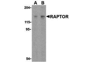 Western Blotting (WB) image for anti-RAPTOR (RAPTOR) (C-Term) antibody (ABIN1030614) (RAPTOR antibody  (C-Term))
