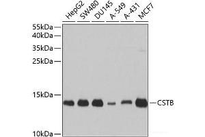 Western blot analysis of extracts of various cell lines using CSTB Polyclonal Antibody at dilution of 1:1000. (CSTB antibody)