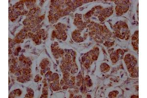 Immunohistochemistry (IHC) image for anti-Solute Carrier Family 16, Member 1 (Monocarboxylic Acid Transporter 1) (SLC16A1) antibody (ABIN7127629)