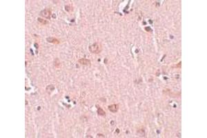 Immunohistochemical staining of human liver tissue with 5 ug/mL PLEKHM2 polyclonal antibody . (PLEKHM2 antibody  (C-Term))