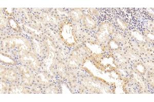 Detection of ITGb1 in Human Kidney Tissue using Monoclonal Antibody to Integrin Beta 1 (ITGb1) (ITGB1 antibody  (AA 140-383))