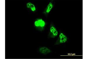 Immunofluorescence of monoclonal antibody to MGC861 on HeLa cell. (CENPM antibody  (AA 1-180))