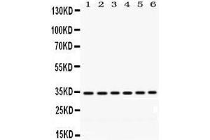 Western Blotting (WB) image for anti-Palmitoyl-Protein Thioesterase 1 (PPT1) (AA 191-224), (C-Term) antibody (ABIN3043357) (PPT1 antibody  (C-Term))