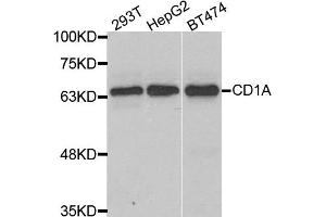 Western blot analysis of extracts of various cell lines, using CD1A antibody. (CD1a antibody)