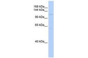 Image no. 1 for anti-SIN3 Transcription Regulator Homolog B (SIN3B) (AA 900-949) antibody (ABIN6741087) (SIN3B antibody  (AA 900-949))