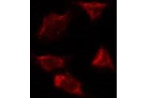ABIN6277505 staining Hela by IF/ICC. (AIMP1 antibody  (Internal Region))