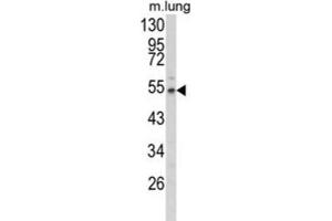 Western Blotting (WB) image for anti-Fibulin 3 (FBLN3) antibody (ABIN3004030) (FBLN3 antibody)