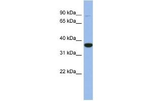 WB Suggested Anti-FANCL Antibody Titration: 0. (FANCL antibody  (Middle Region))