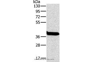 Western blot analysis of Mouse liver tissue, using OTC Polyclonal Antibody at dilution of 1:800 (OTC antibody)