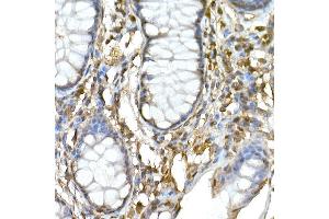 Immunohistochemistry of paraffin-embedded human colon using TNF Rabbit pAb (ABIN3022984, ABIN3022985, ABIN3022986 and ABIN6219332) at dilution of 1:50 (40x lens). (TNFAIP3 antibody  (AA 1-190))
