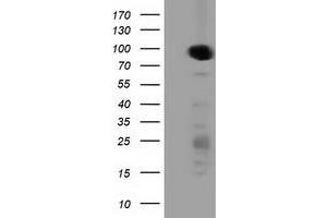 HEK293T cells were transfected with the pCMV6-ENTRY control (Left lane) or pCMV6-ENTRY PRKD2 (Right lane) cDNA for 48 hrs and lysed. (PKD2 antibody)