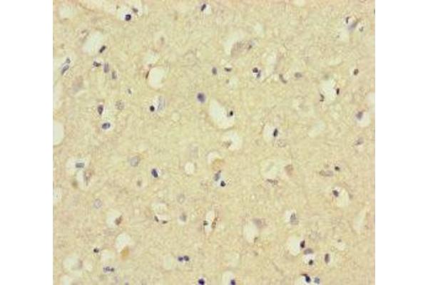 CNGA4 antibody  (AA 1-575)