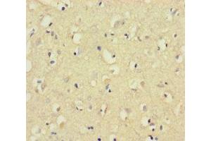 Immunohistochemistry of paraffin-embedded human brain tissue using ABIN7148826 at dilution of 1:100