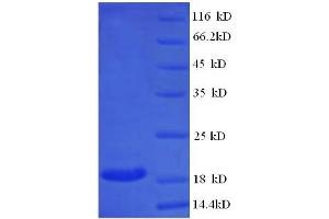 CLTCL1 Protein (AA 1423-1566) (His tag)