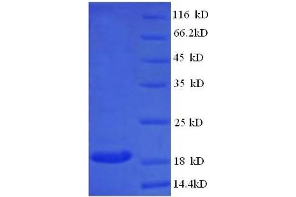 CLTCL1 Protein (AA 1423-1566) (His tag)