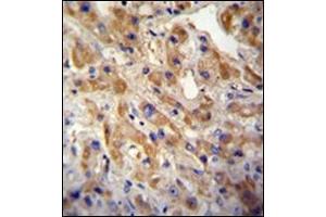 Immunohistochemistry (IHC) image for anti-Met Proto-Oncogene (MET) (Catalytic Domain) antibody (ABIN356340) (c-MET antibody  (Catalytic Domain))