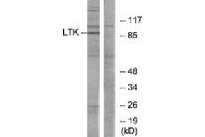 Western blot analysis of extracts from Jurkat cells, using LTK Antibody. (LTK antibody  (AA 206-255))
